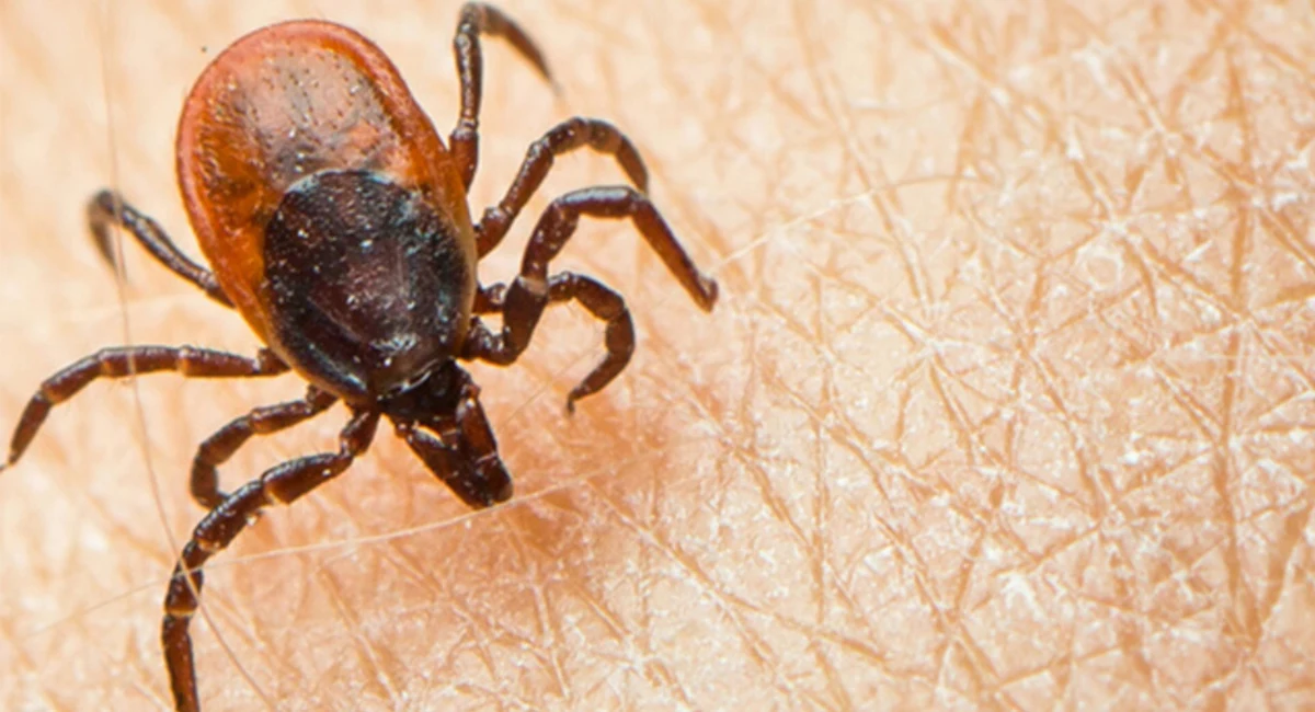 An engorged brown tick on human skin.