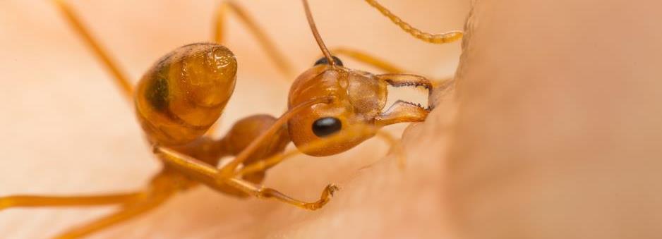 Ant biting skin